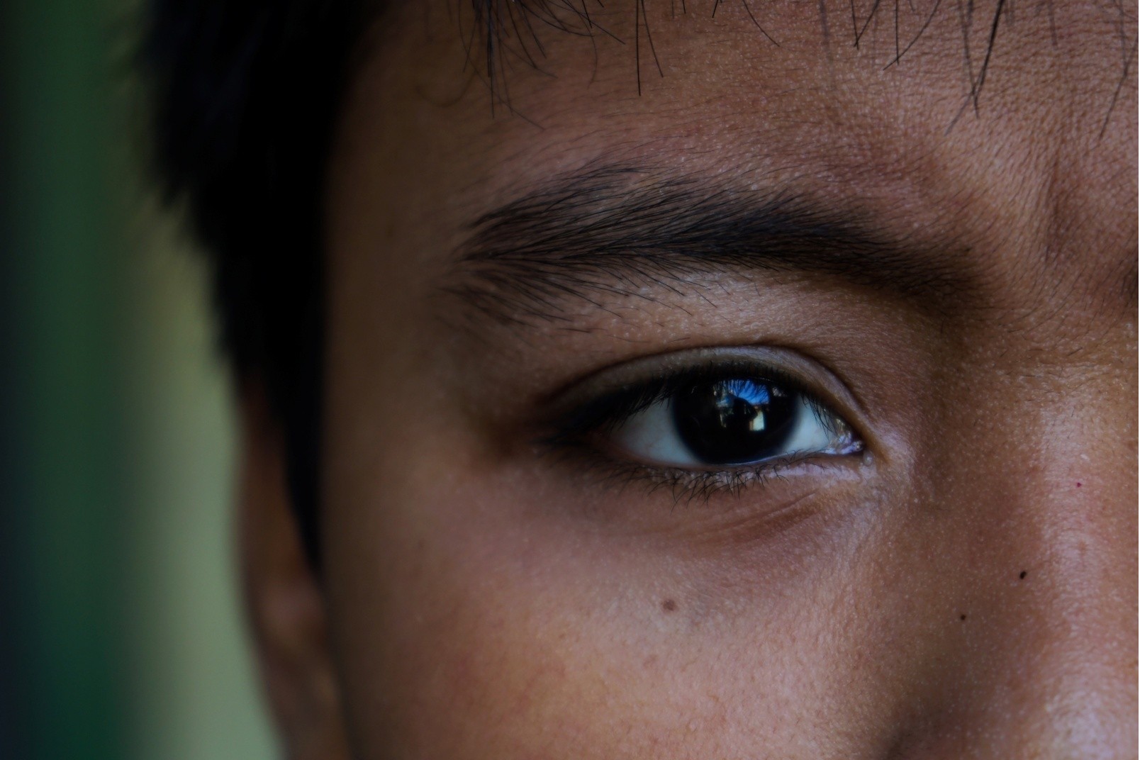 AkshayNetra - Eye Image