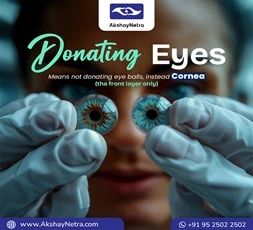 Donating Eyes